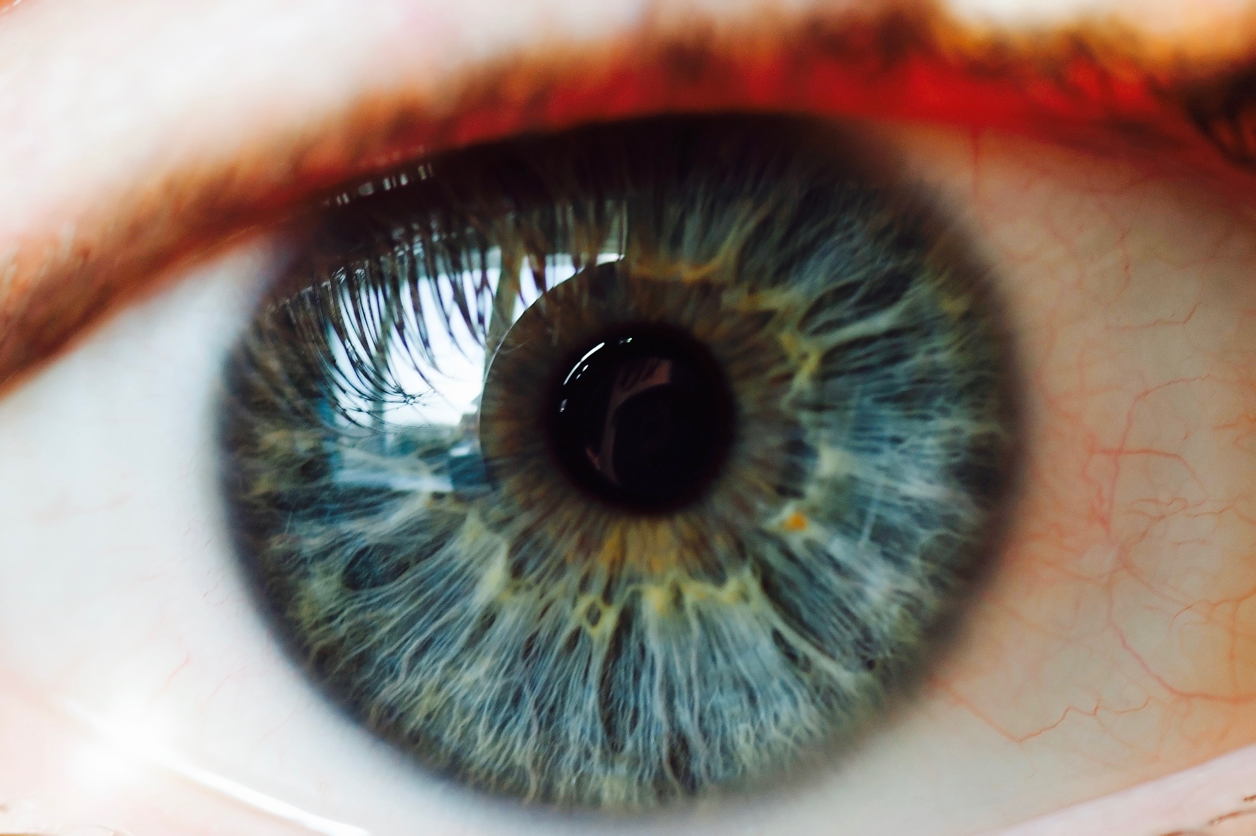 Голубые глаза с коричневыми вкраплениями